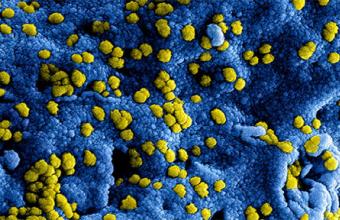 coronavirus 2